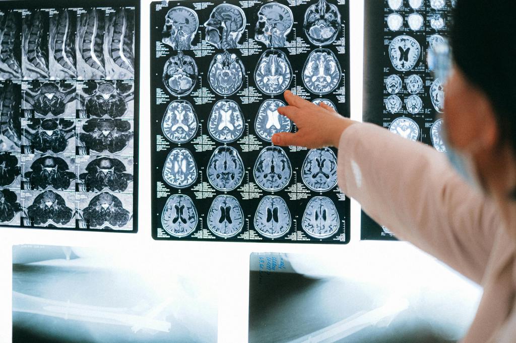 Doctor showing MRI Brain scan images